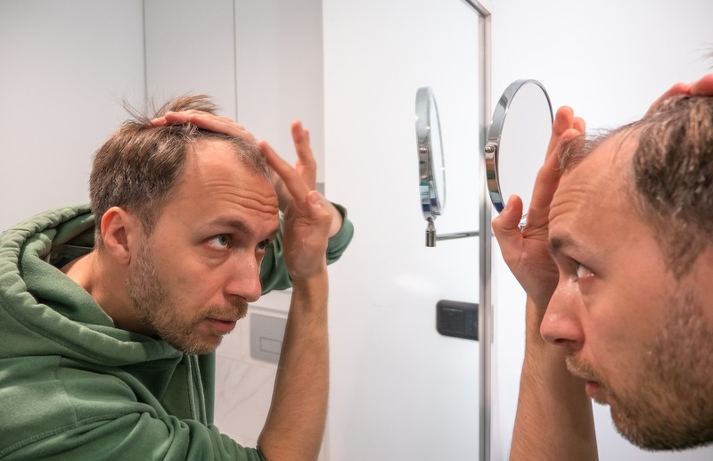 Der richtige Haarschnitt macht bei Geheimratsecken und Haarausfall einen großen Unterschied.
