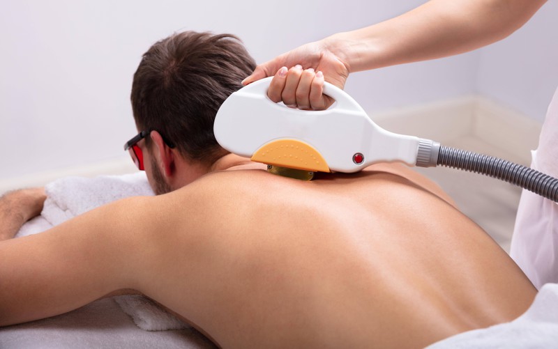 Immer mehr Männer lassen sich die Rückenhaare mit einer Laserbehandlung oder einem IPL-Gerät entfernen.